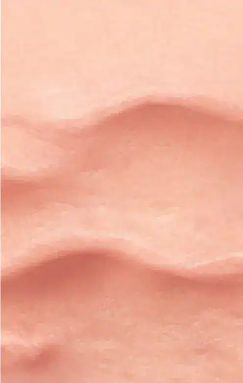 type of acne -rolling scars