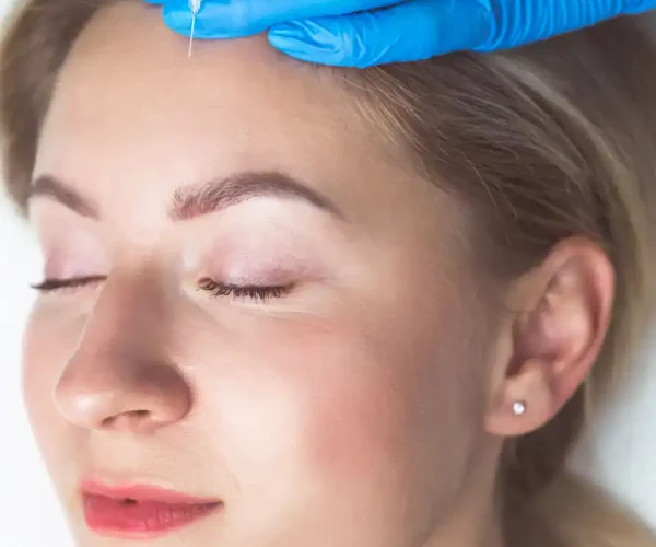 woman receiving filler