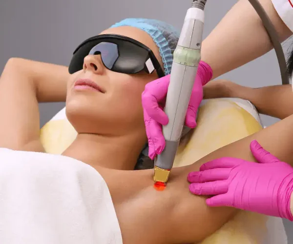 woman getting laser hair removal treatment underarms treatment with clarity II