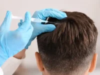 man getting alopecia treatment