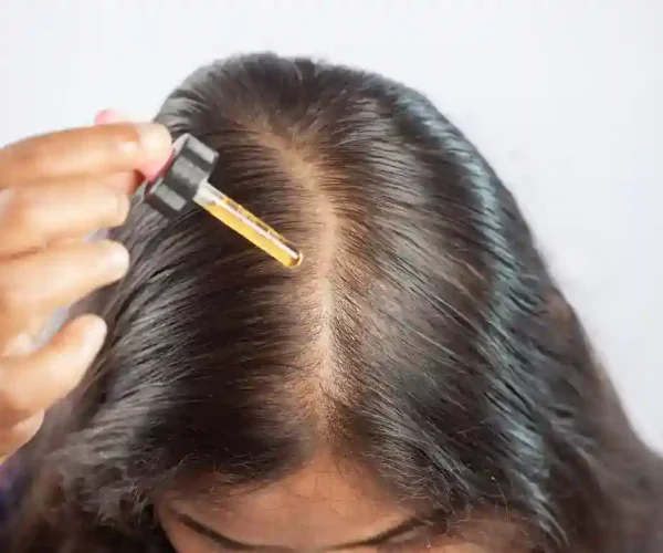 woman applying topical Minoxidil