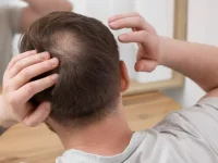 Male Pattern Baldness Treatment Airmont, man looking at mirror