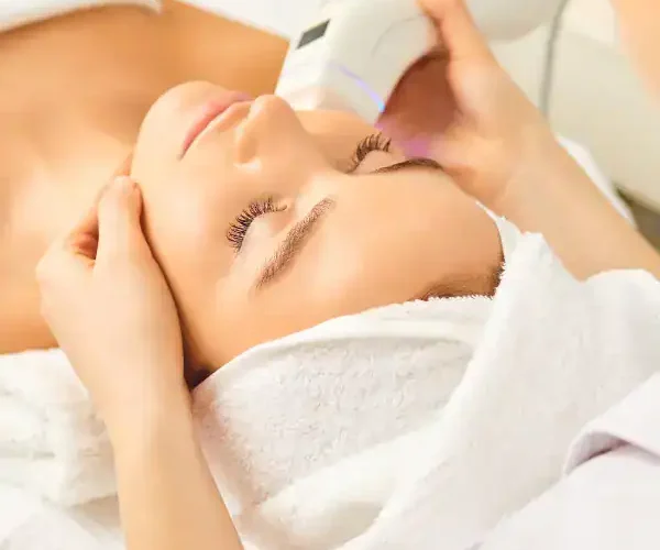 rosacea laser treatment process