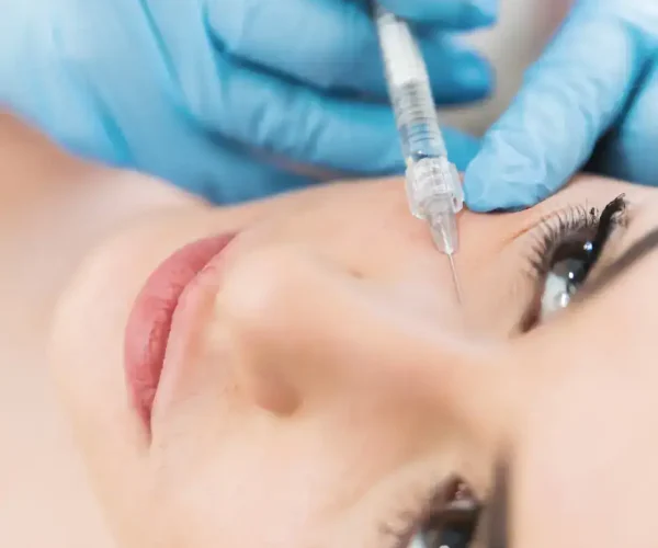 under eye filler