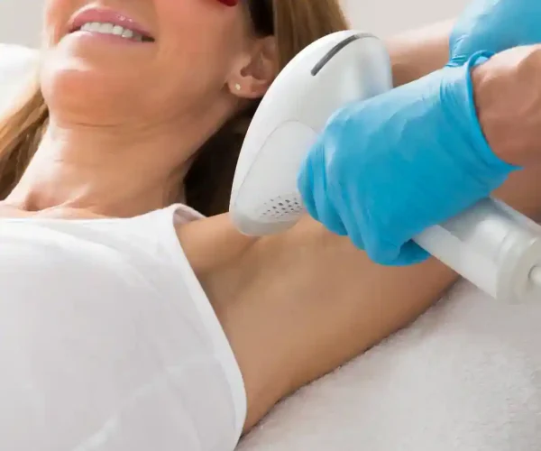 woman getting underarm laser hair removal treatment